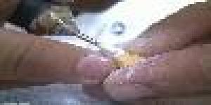 Laboratorio dental Lablemma